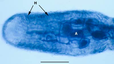 Dual ECM and VAM in Melaleuca uncinata