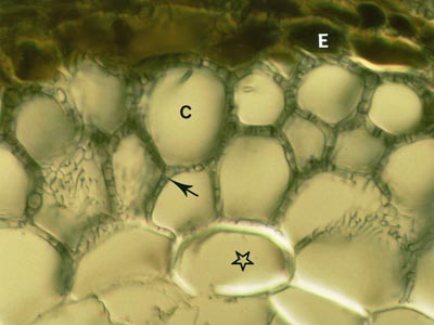 Hartig net of Picea (13KB)