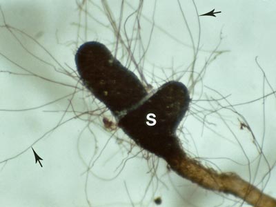 Cenococcum ECM root