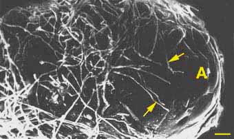 SEM of early stage of pine ECM (15KB)