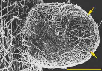 SEM of later stage of pine ECM (21KB)