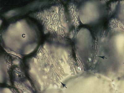 Hartig net of ectomycorrhizal Pinus root