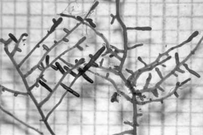 Root system of Populus with ECM short roots