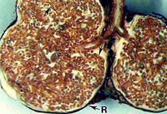 tuberculate ECM roots of Eucalyptus (17KB)