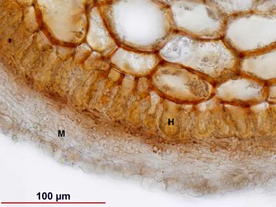 Gnetum ECM root cross section