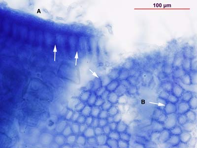 Gnetum ECM root squashed