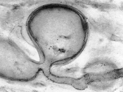 400 MY old fossil mycorrhiza-like association in Aglaophyton rhizome