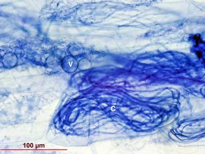 Psilotum nudum VAM coils