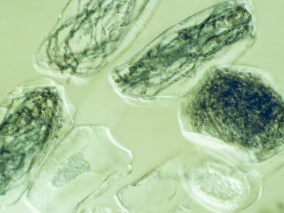 Hiphal coils in Epipactis root