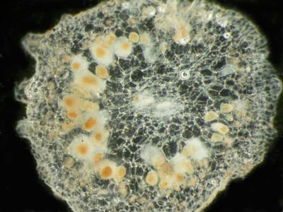 mycorrizal association in Rhizanthella rhizome