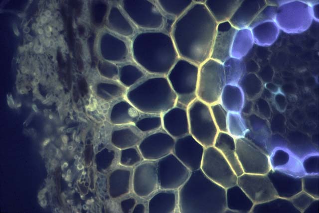 Autofluorescence of ectomycorrhiza (38 KB)