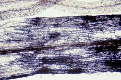 Unadentified fungus on Scaevola root
