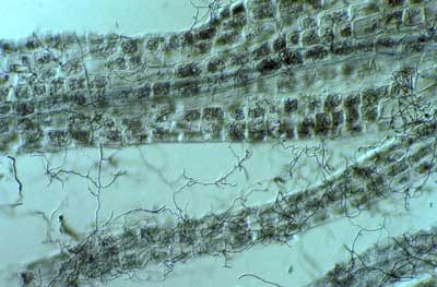 Leucopogon mycorrhiza (16KB)