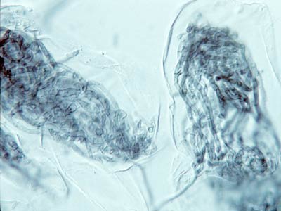 Hyphal coils in orchid root cells (28KB)