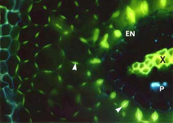 Phi Thickenings in a cedar root (12KB)