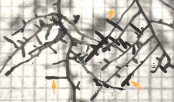 Ectomycorrhizal short roots (16KB)