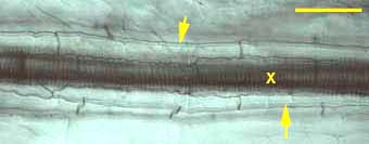 Xylem and endodermis (8KB)