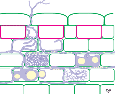 Acaulospora VAM morphology (16KB)