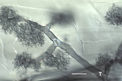 Arbuscule of Gigaspora