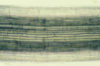 Longitudinal air cannels in a root