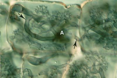 Coils and arbuscules