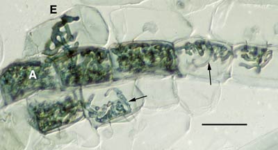 Colony with hyphal coils