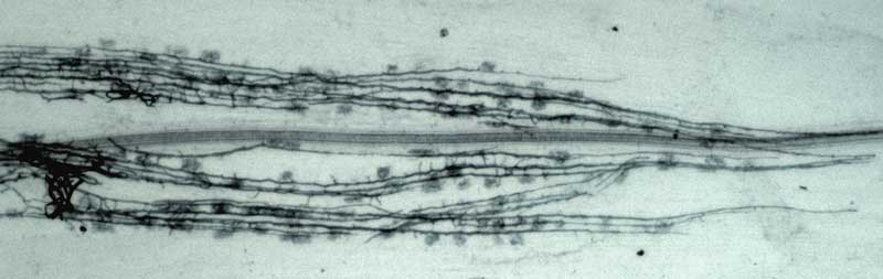 Linear colony of VAM