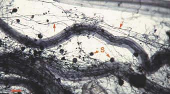 VAM soil hyphae (16KB)