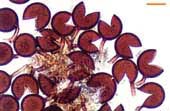 Glomus sporocarp (6KB)